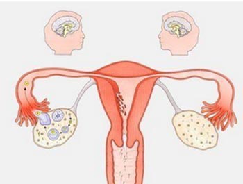 毕节女性良性卵巢囊肿一般多大