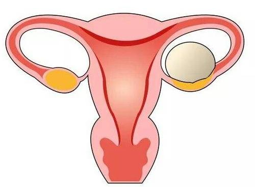 毕节妇女为什么会长卵巢囊肿