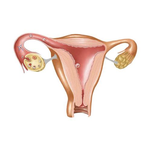 毕节妇女急性子宫内膜炎一般有什么症状