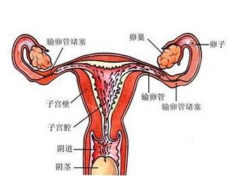 毕节妇女卵巢囊肿7厘米应该怎么办