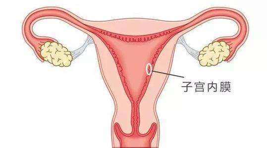 毕节妇女得子宫内膜炎的症状是什么
